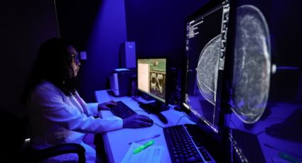 ISSSTE activa Inteligencia Artificial para detectar cáncer de mama