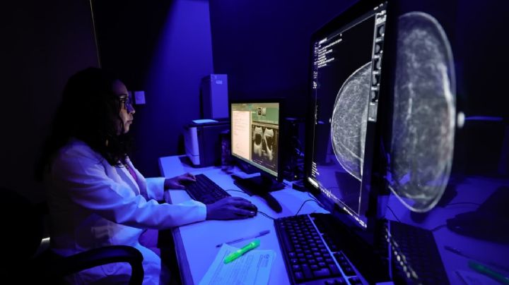 ISSSTE activa Inteligencia Artificial para detectar cáncer de mama