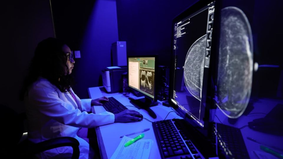 La estrategia permitirá agilizar diagnósticos, detectar oportunamente cáncer de mama.