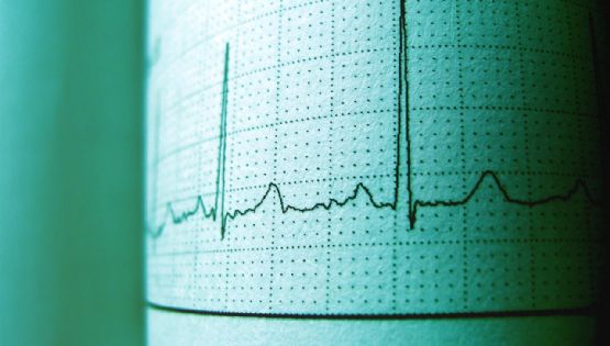 Microsismo de magnitud 2 en Álvaro Obregón hoy 3 de junio de 2026