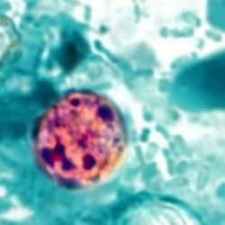 Salud emite aviso por brote de ciclosporiasis en EU