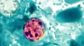 Salud emite aviso por brote de ciclosporiasis en EU