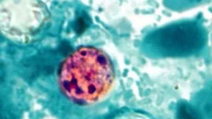Salud emite aviso por brote de ciclosporiasis en EU