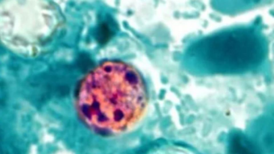La Secretaría de Salud federal ha publicado una alerta sanitaria debido a la propagación del parásito Cyclospora cayetanensis.